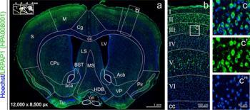 mouse_brain_example_hpa008001.jpg