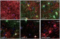 CKB_astrocytes3.PNG